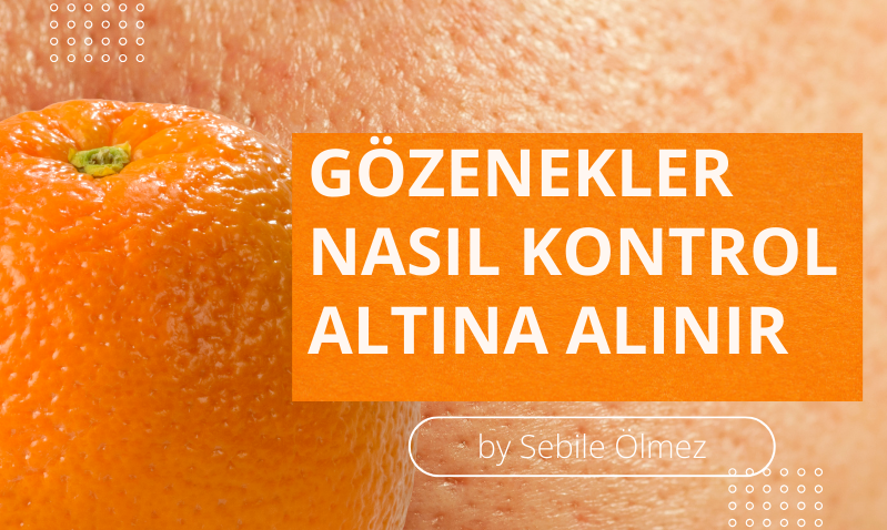 Gözenekler Nasıl Kontrol Altına Alınır